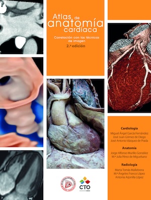 Atlas de anatomía cardíaca Atlas de anatomía cardíaca
