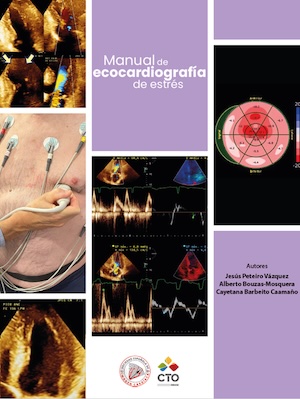 Manual de ecocardiografía de estrés Manual de ecocardiografía de estrés